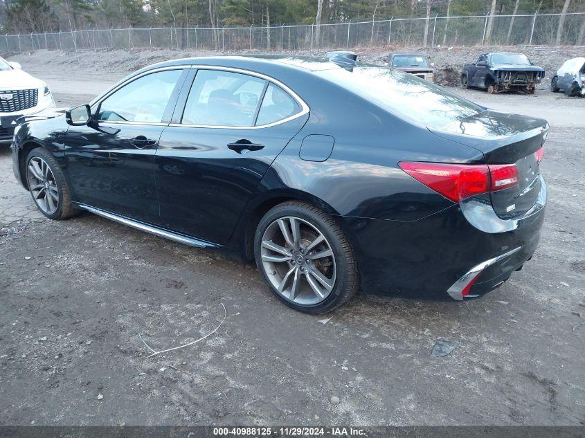 ACURA TLX TECH PACKAGE 2020