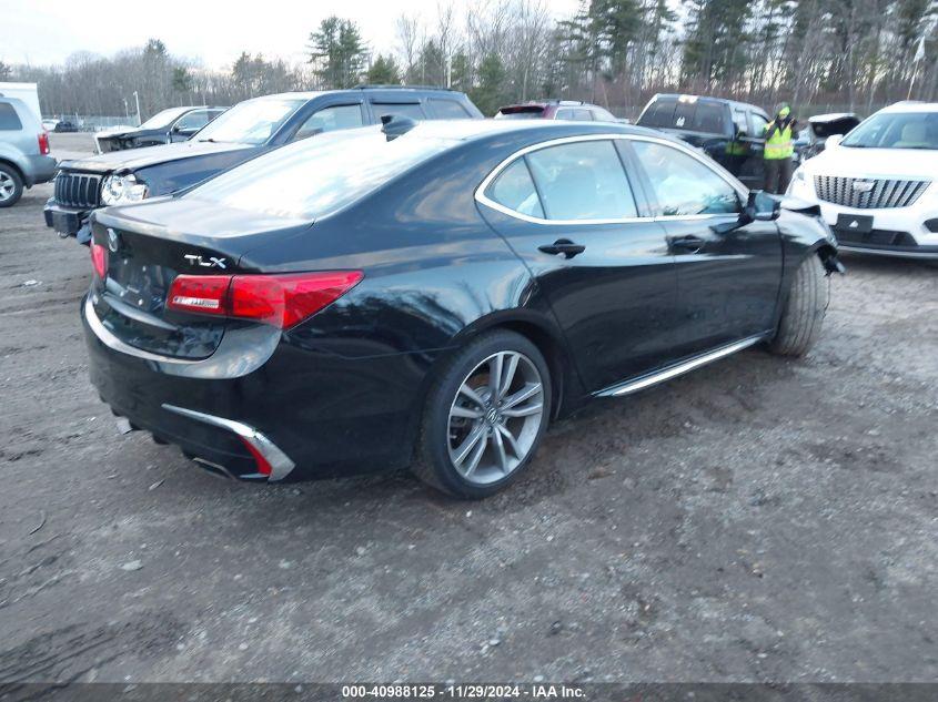 ACURA TLX TECH PACKAGE 2020